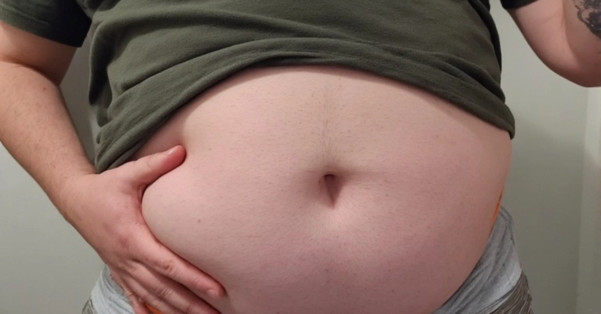 मोटोपन घटाउने केही घरेलु तरिकाहरु (Home Remedies for Obesity)