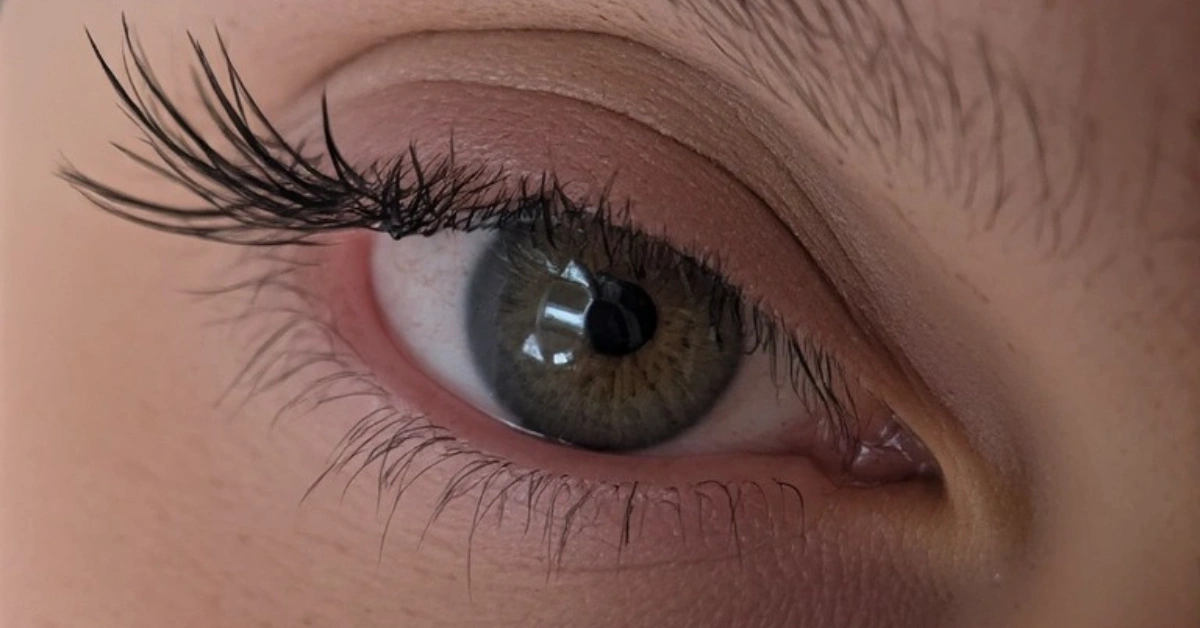 आँखाको रोग (Eye Diseases)